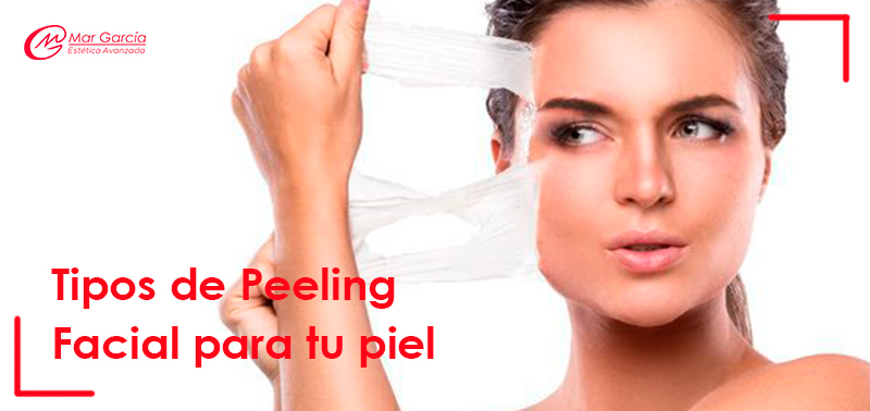 Peeling laser antes y despues de adelgazar