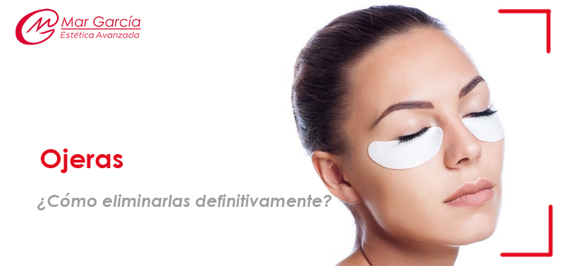 eliminar ojeras
