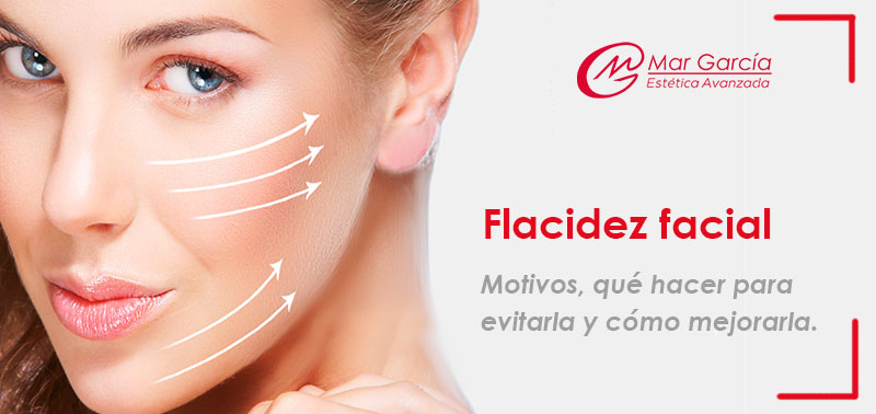 Flacidez-facial