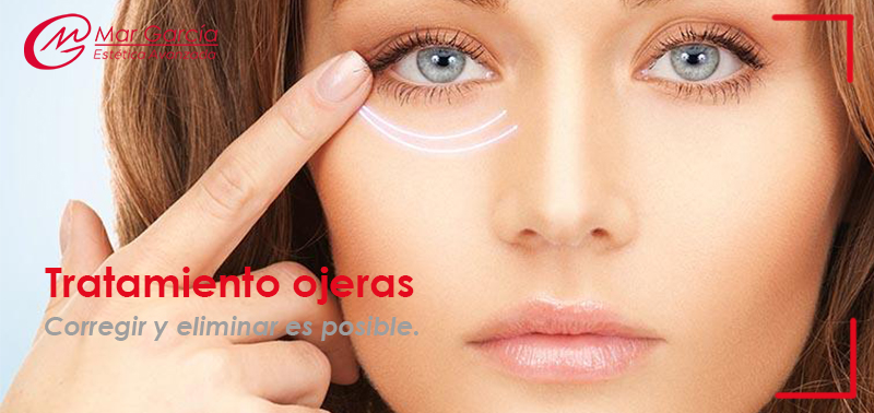 Tratamiento ojeras_Centro Mar Garcia