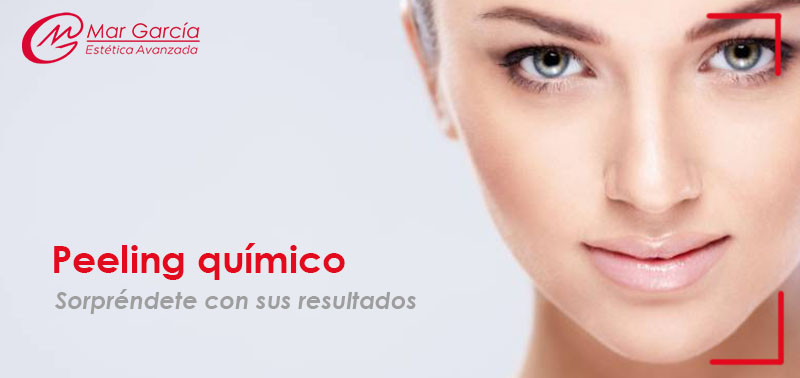 Peeling químico sorpréndete con sus resultados_Centro Mar García