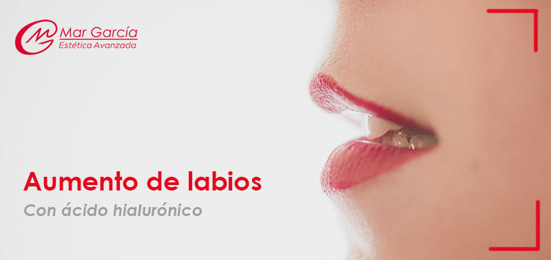 Aumento de labios