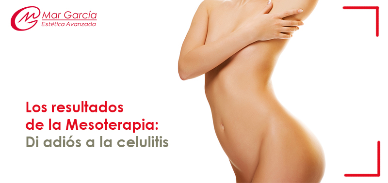 Mesoterapia Di adios a la celulitis Centro Mar Garcia Mesoterapia Corporal Alidya: Resultados contra la celulitis