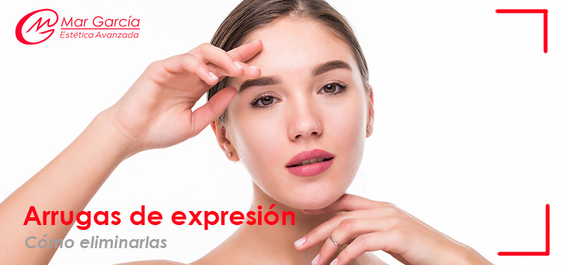 Arrugas arrugas de expresión