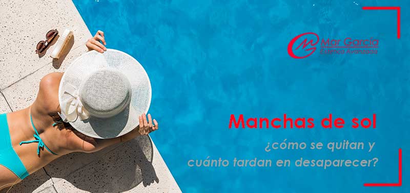 Manchas-del-sol