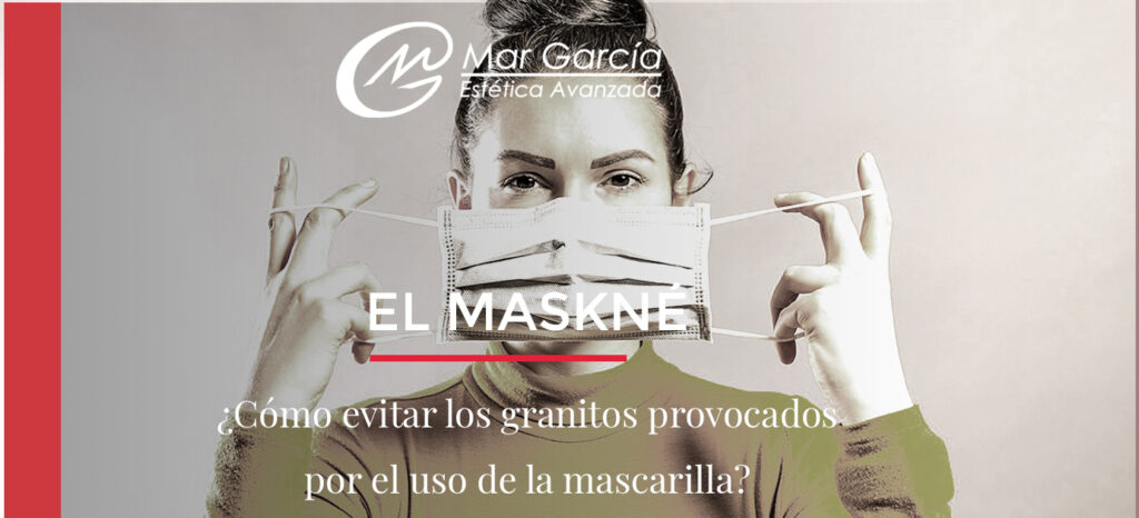 Maskne acné por mascarilla – Mar Garcia Estética Acné por mascarilla - Granos en la cara