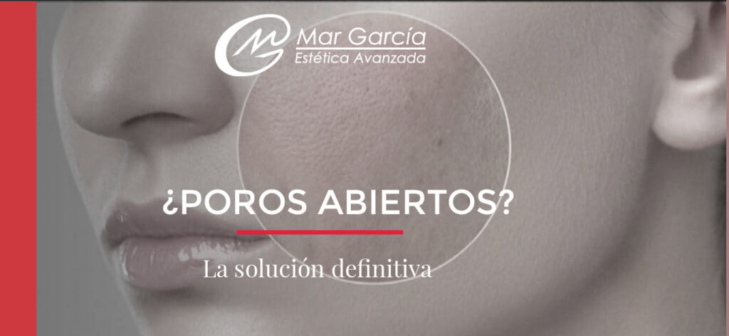 Solucionar poros abiertos – Mar Garcia Estética Avanzada Poros abiertos Solución definitiva