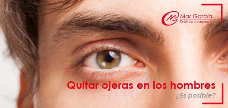 quitar las ojeras en los hombres