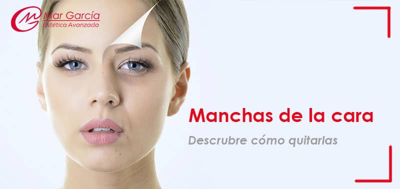 manchas de la cara