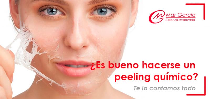 Es bueno hacerse un peeling químico facial