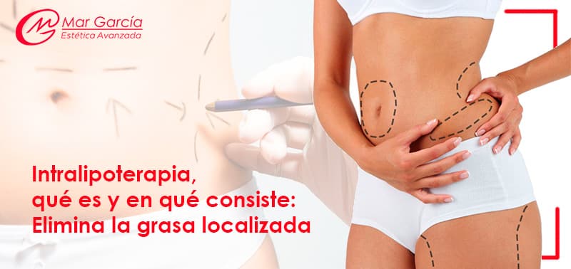 intralipoterapia