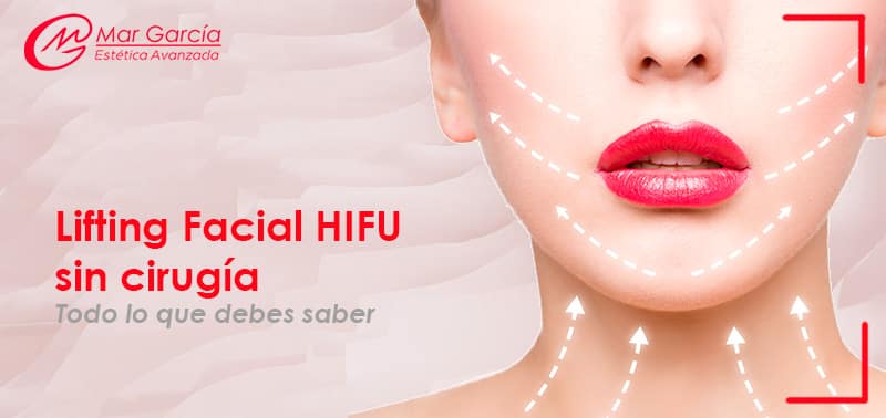 hifu facial sin ciugia