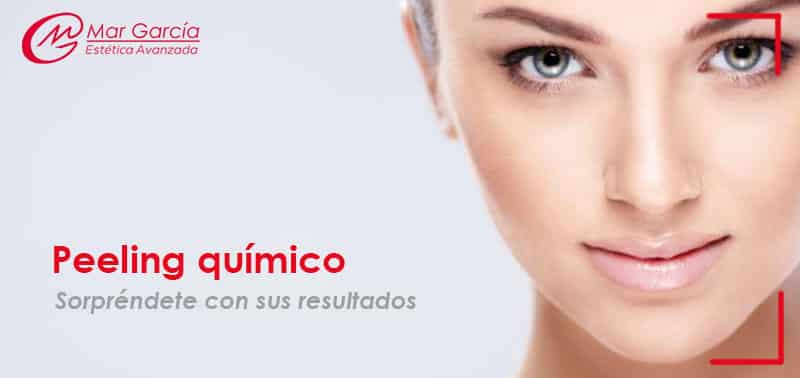 peeling químico facial