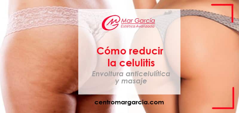 Cómo eliminar la celulitis de los glúteos - Centro de Dermatología