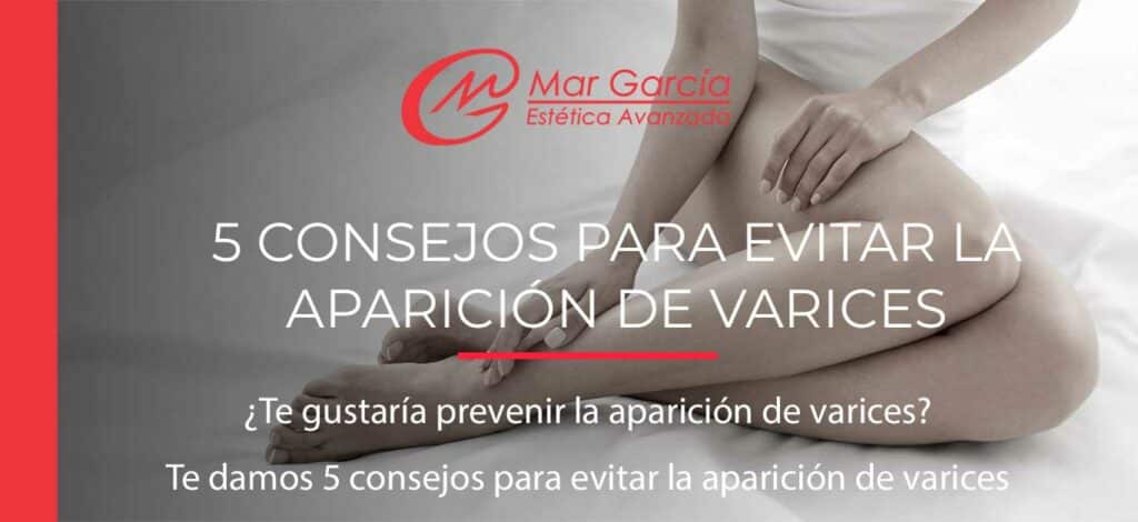 evitar la aparición de varices