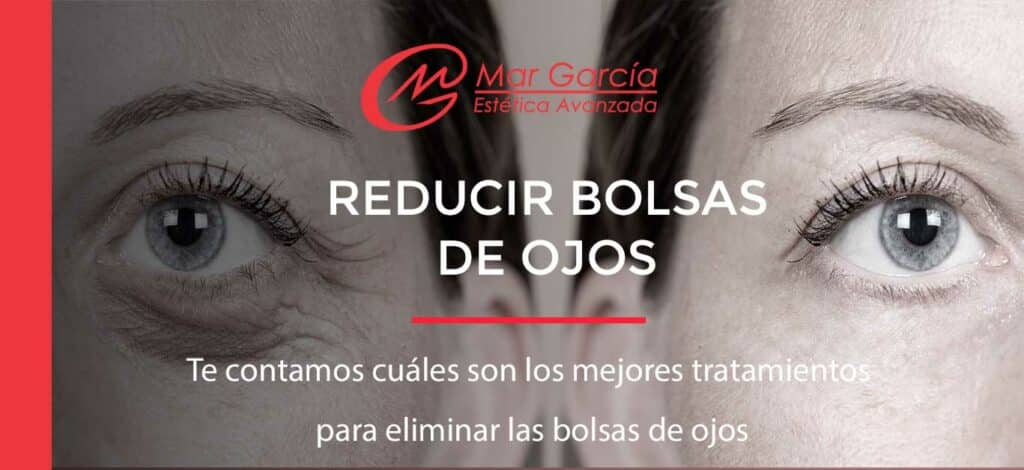 reducir bolsas de ojos