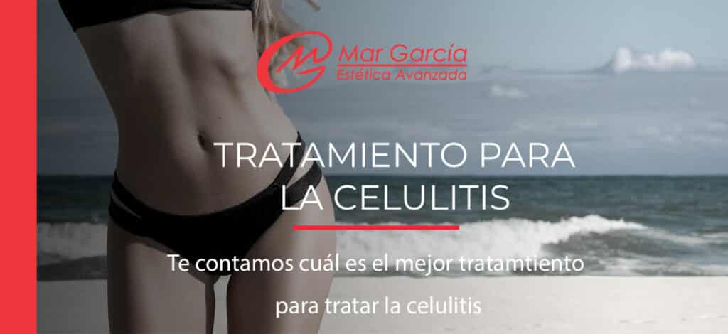 tratamiento-para-la-celulitis