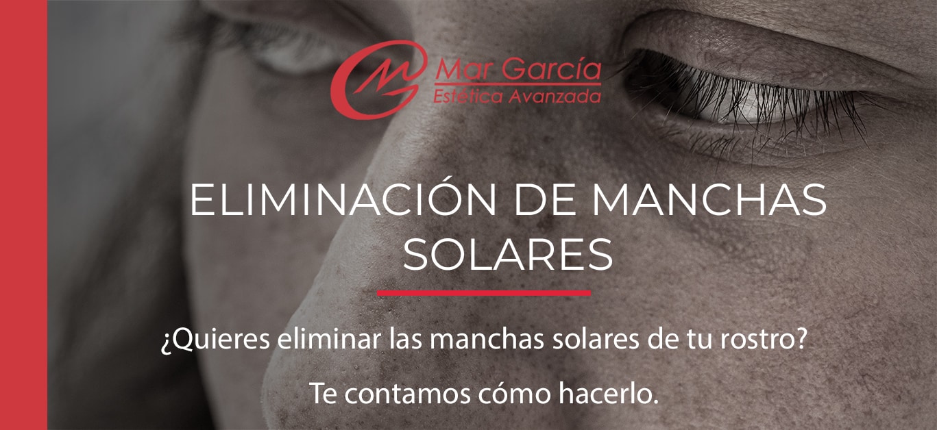 eliminación de manchas solares