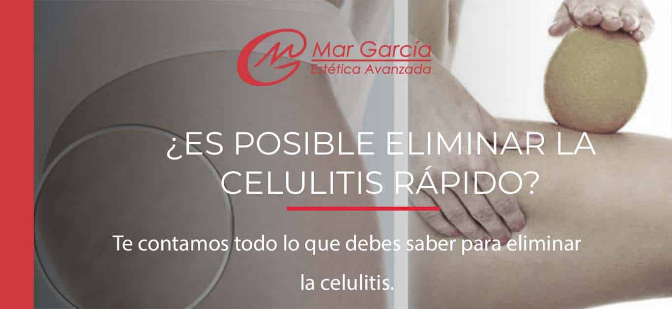 Eliminar la celulitis rapido