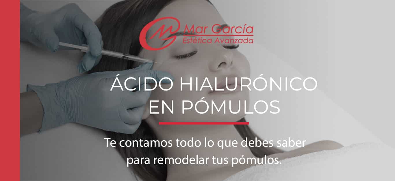 Ácido hialurónico pómulos