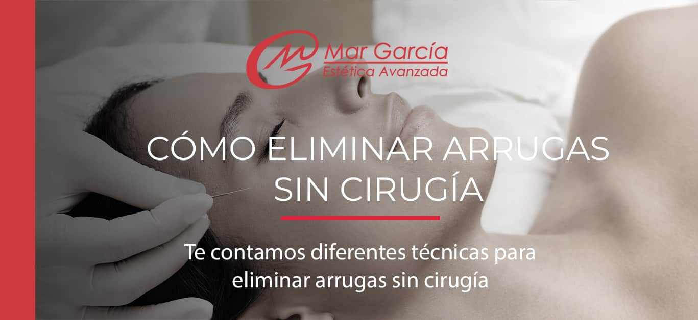 Como eliminar arrugas sin cirugia