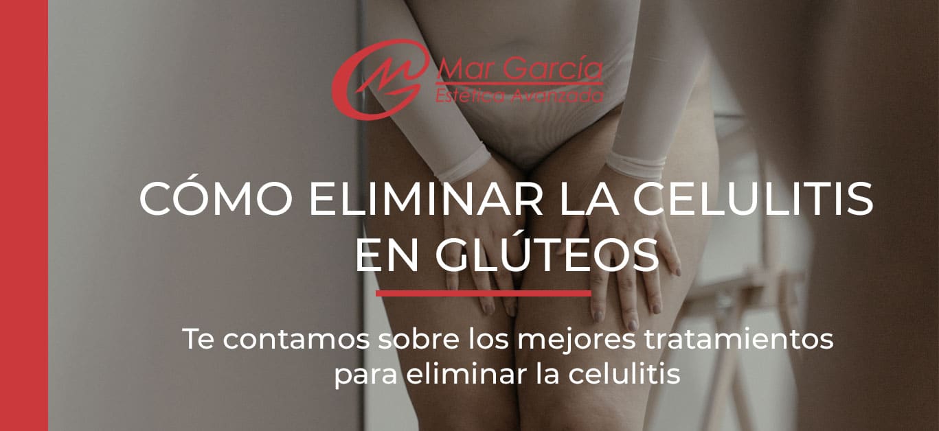 Como eliminar la celulitis en los gluteos