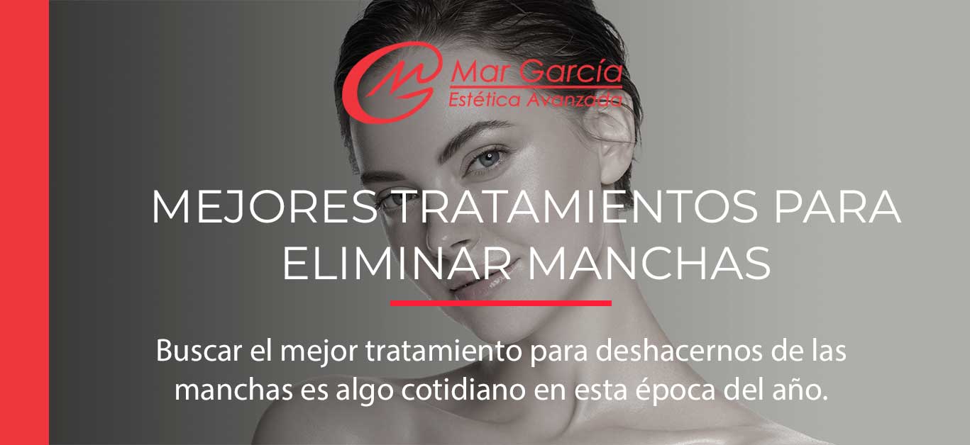 Mejores tratamientos para eliminar manchas