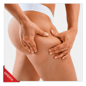 Mesoterapia