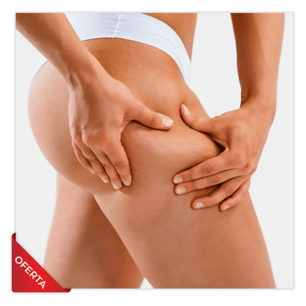 Mesoterapia