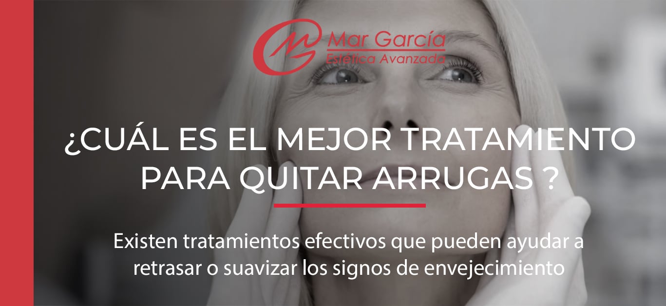 mejor tratamiento para quitar arrugas