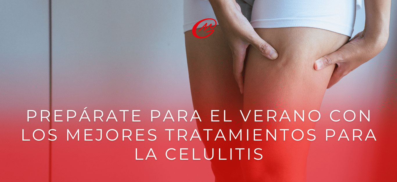 Prepárate para el verano con los mejores tratamientos para la celulitis