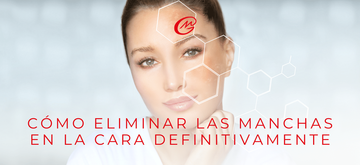 Cómo eliminar las manchas en la cara definitivamente