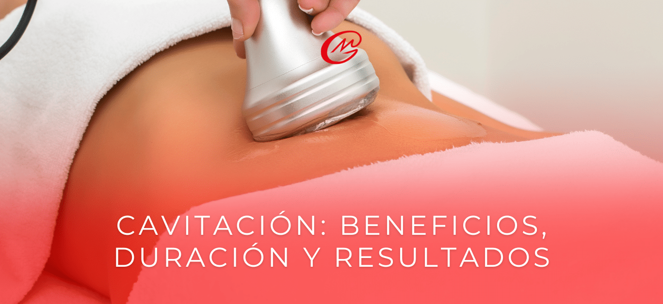 Cavitación_ beneficios, duración y resultados