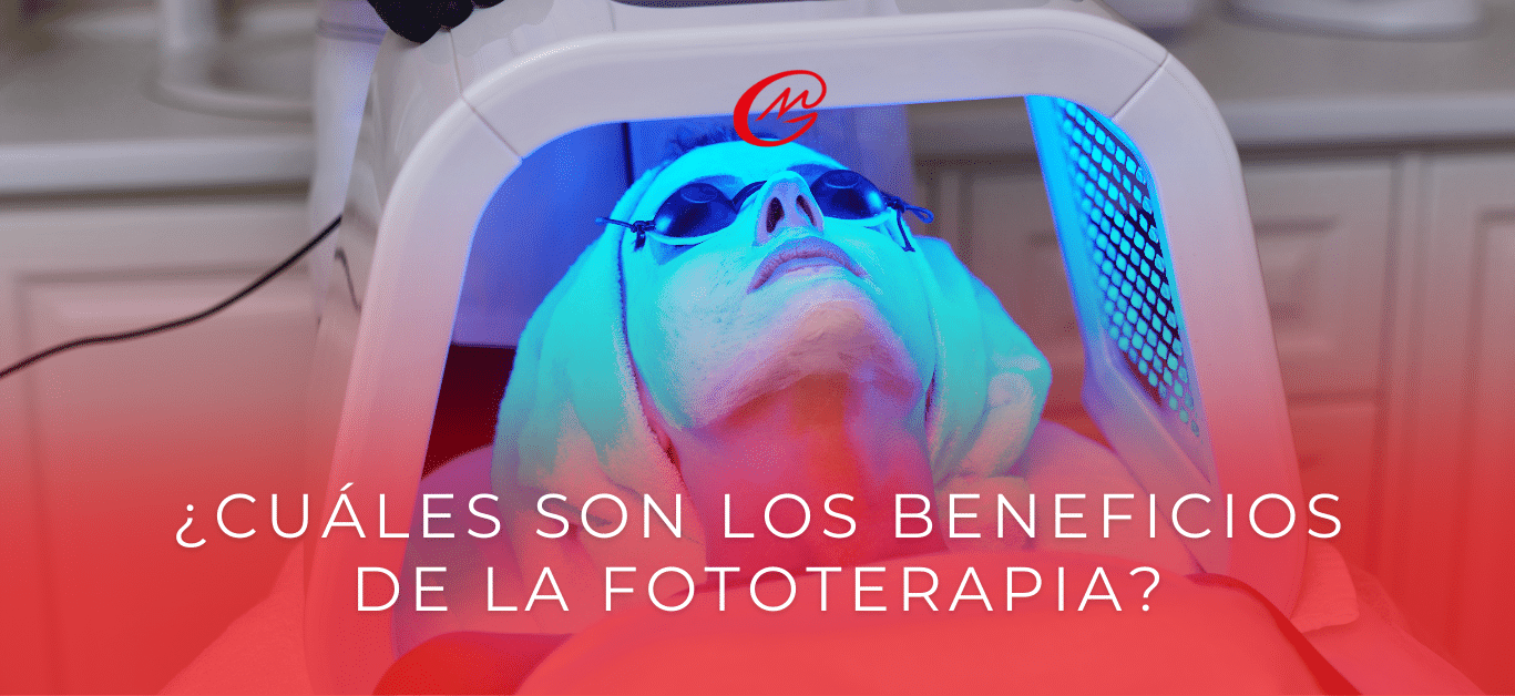 Cuáles son los beneficios de la fototerapia