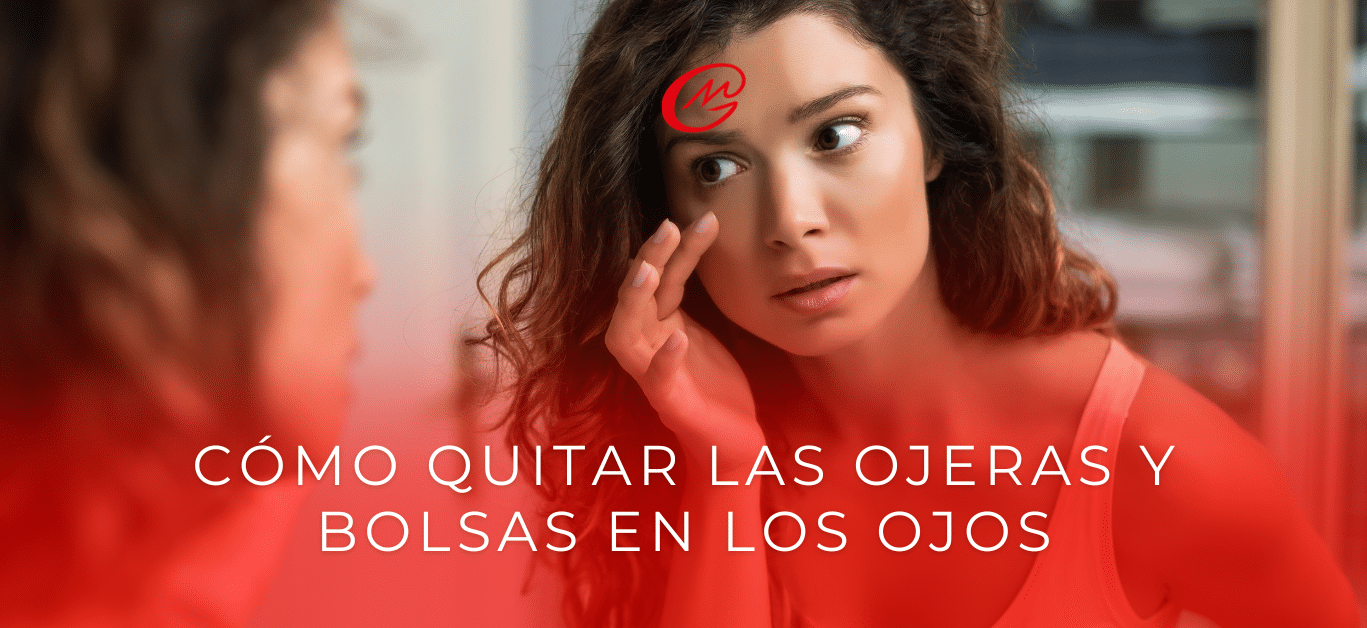 Cómo quitar las ojeras y las bolsas en los ojos