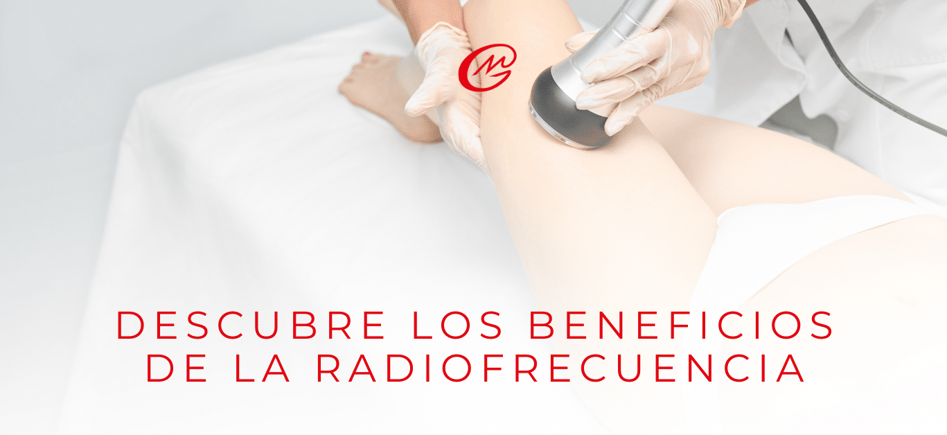 Descubre los beneficios de la radiofrecuencia