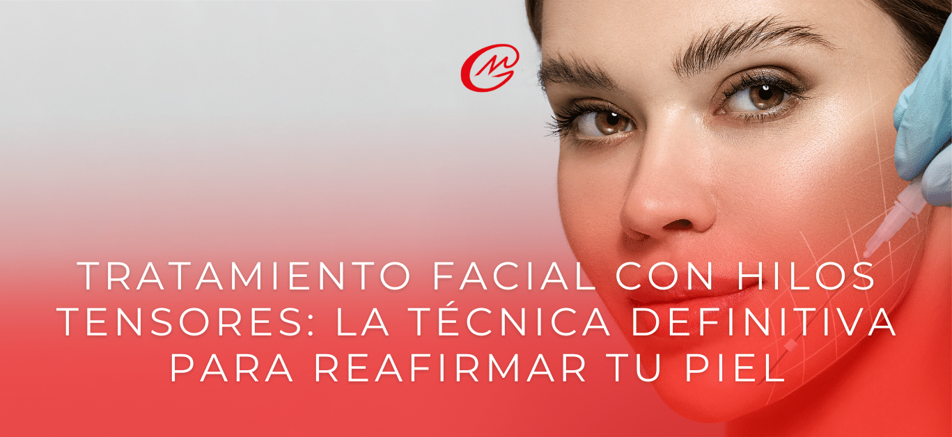 Tratamiento facial con hilos tensores_ la técnica definitiva para reafirmar tu piel