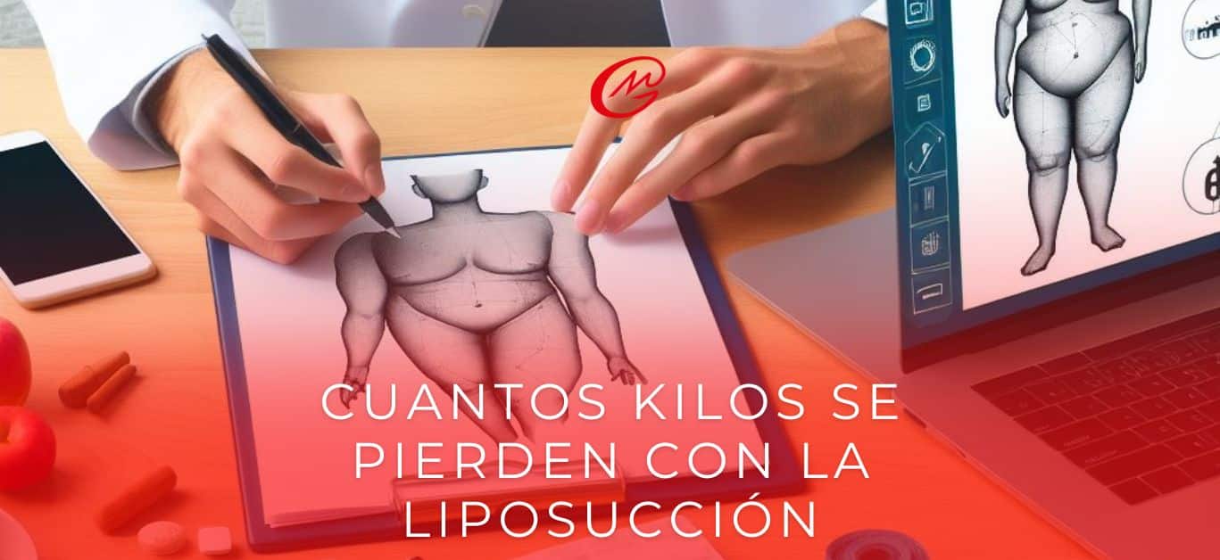 Cuantos kilos se pierden con la Liposucción